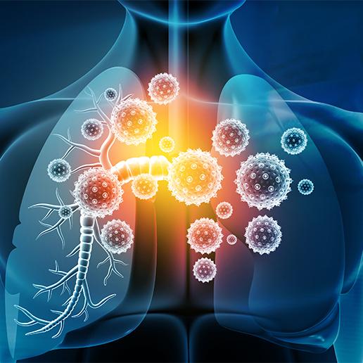 Pitting bacteria against bacteria in the fight against lung infections