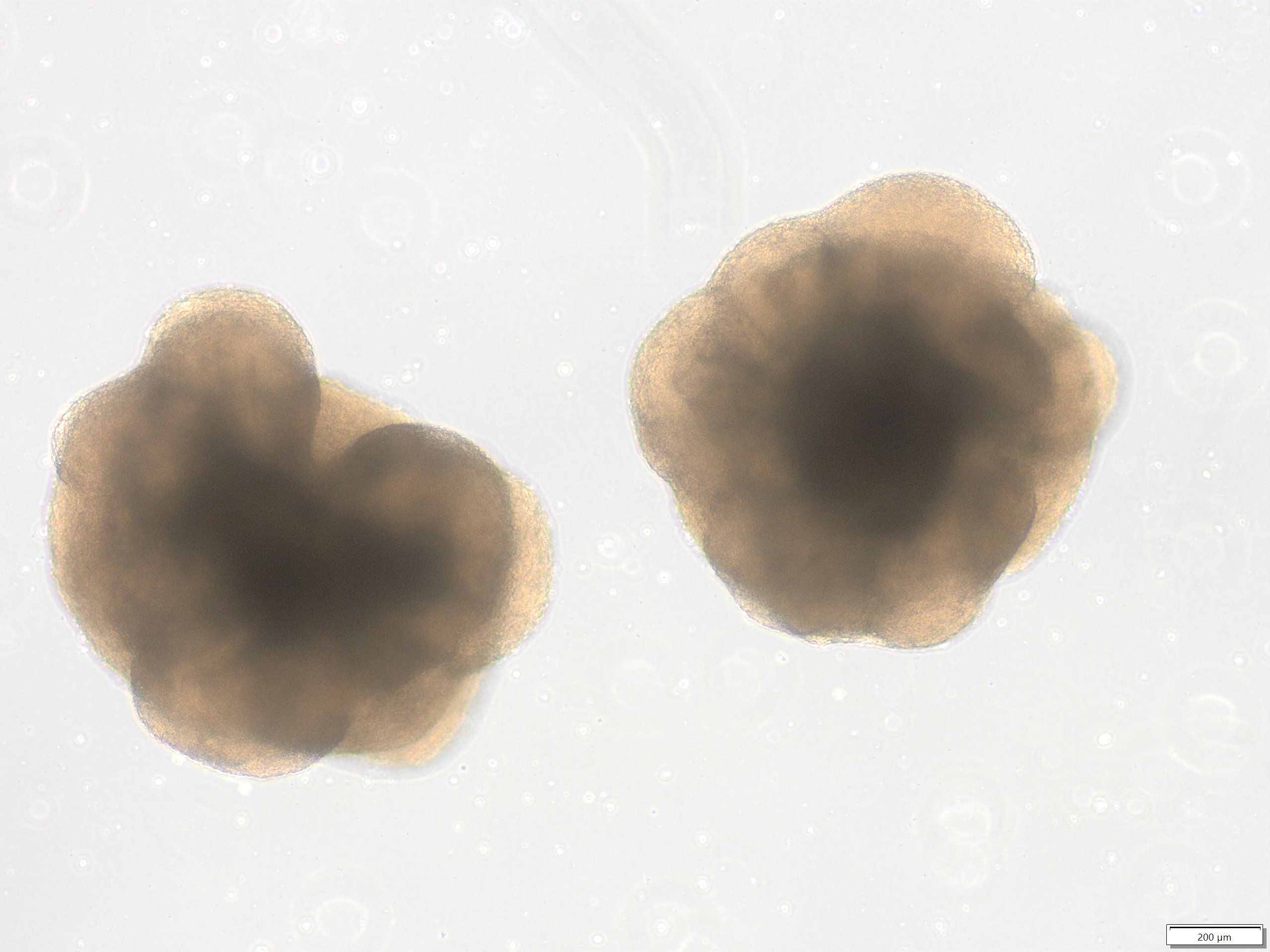 Descubren una limitación en los ‘minicerebros’ cultivados en laboratorio