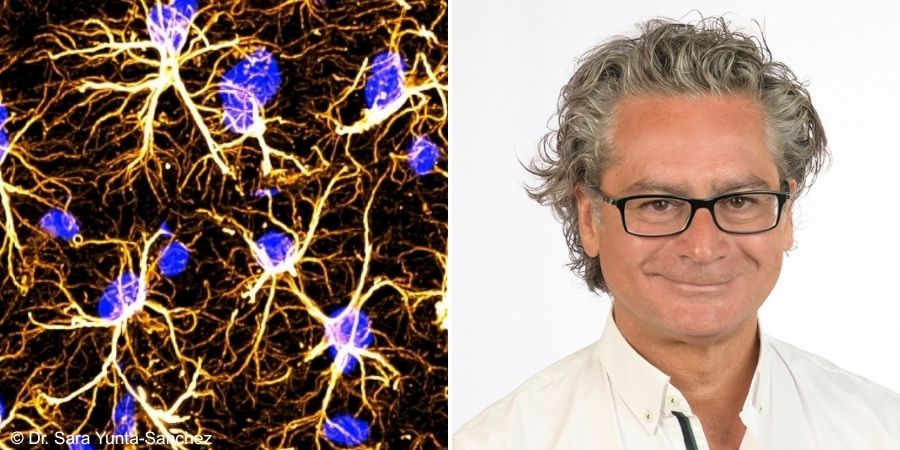 Move, eat, think: How lifestyle shapes your brain