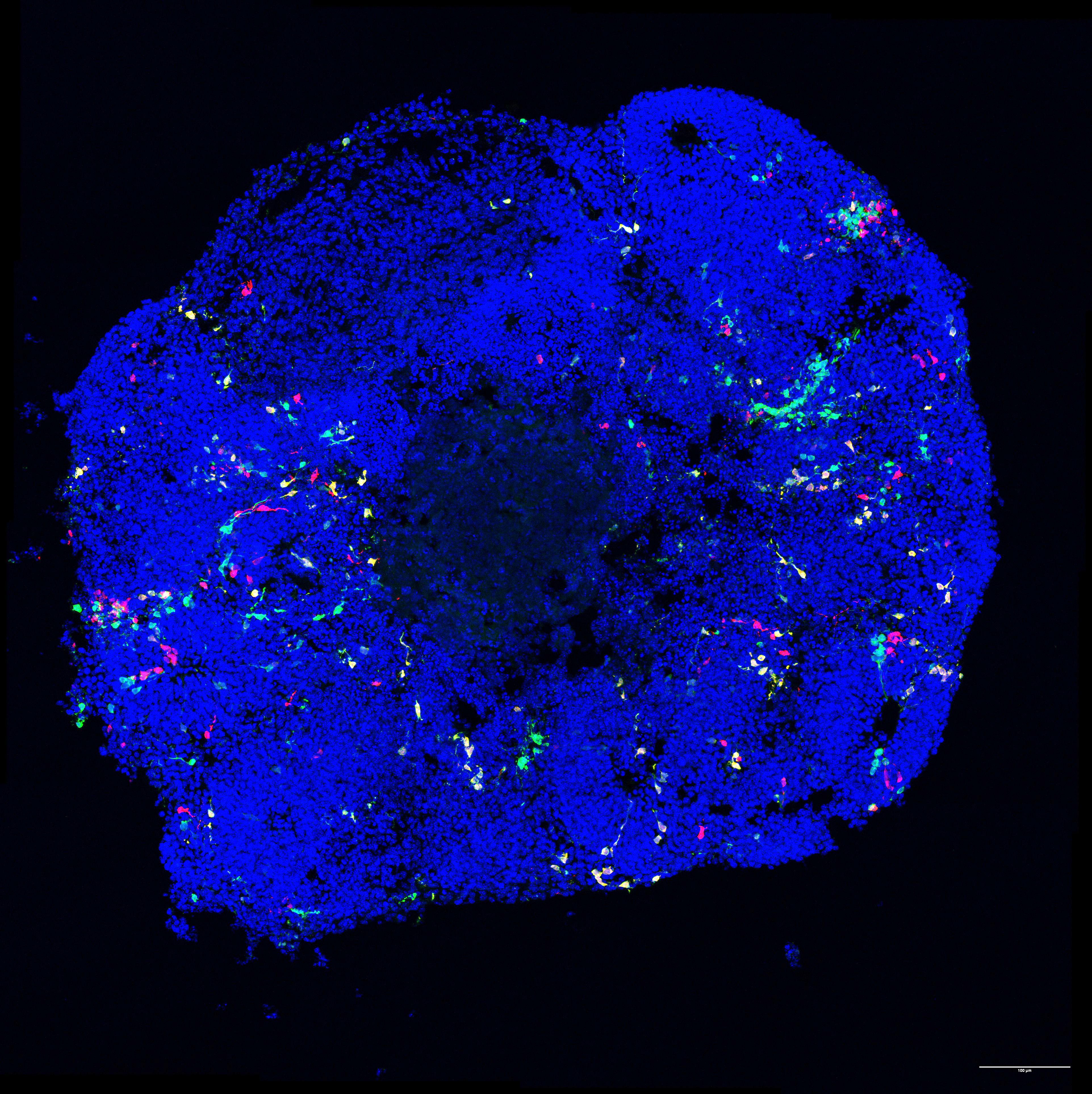 MADM organoid 