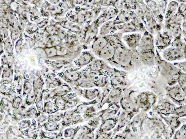 Cover image of An early detection kit for colorectal cancer Cover image of An early detection kit for colorectal cancer
