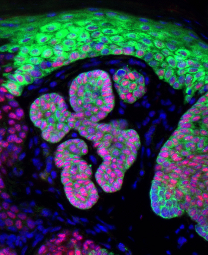 Cover image of Understanding the role of stem cells in skin cancer