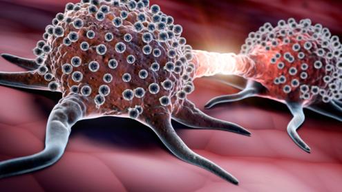 Cover image of What drives tumour metastasis?