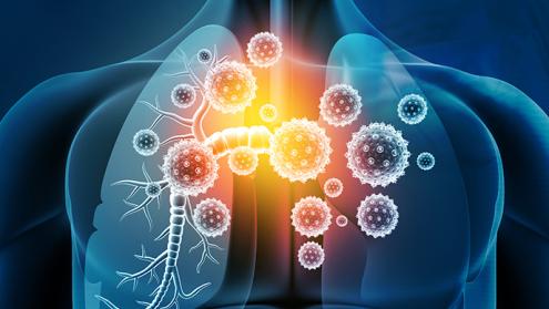 Pitting bacteria against bacteria in the fight against lung infections Pitting bacteria against bacteria in the fight against lung infections
