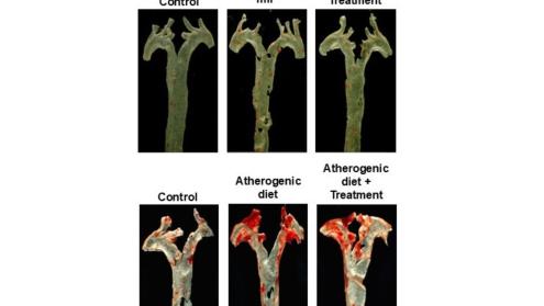 Aortas from mice treated with the bacterial metabolite imidazole propionate (ImP)