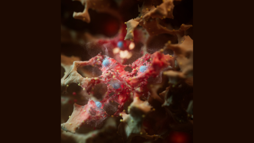 artistic representation of the internal surface of an inflamed alveolus, with significant accumulation of damage that ultimately leads to the release of a 1