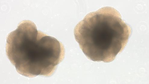 Two brain organoids 