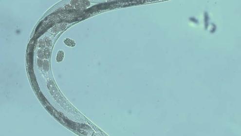 Cover image of Long-lived worms hold the secret for healthy ageing in humans