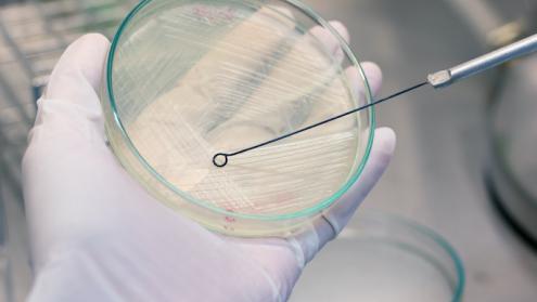 Cover image of Diagnostic kit delivers quick antiobiotic resistance assessment
