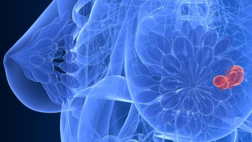Cover image of Innovative EU research targets breast cancer