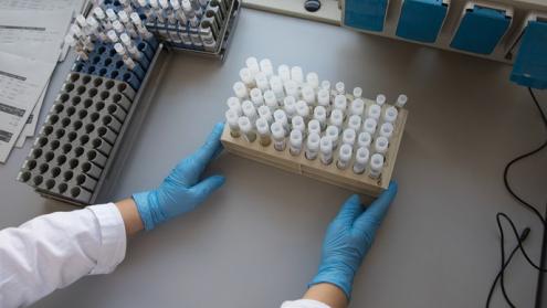 Cover image of Mapping the global molecular diagnostics industry for COVID-19 tests