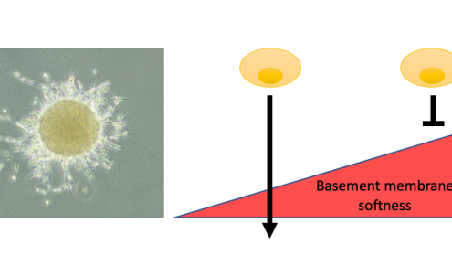 Cover image of New scientific discovery may enable accurate prediction of cancer spread even before cancer develops