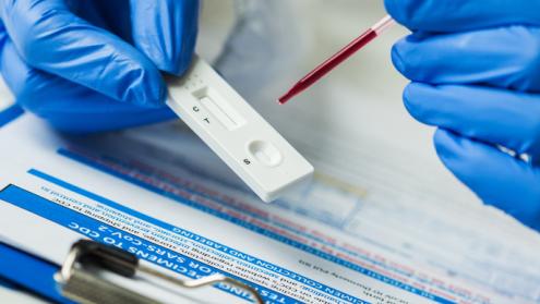 Cover image of Rapid diagnostic test inspired by fireflies could help fight COVID-19