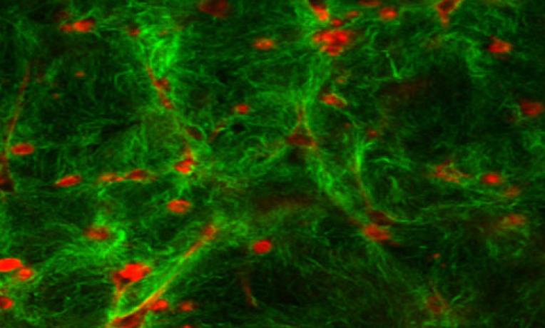 Cover image of A new weapon against pancreatic cancer on the way ? Cover image of A new weapon against pancreatic cancer on the way ?