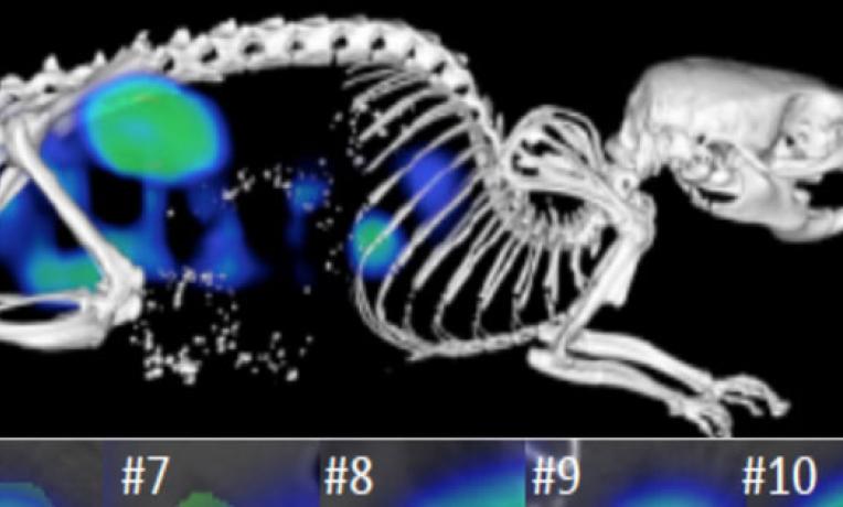 Cover image of Medical imaging: Can we predict how cancer patients will respond to nanotherapies? Cover image of Medical imaging: Can we predict how cancer patients will respond to nanotherapies?