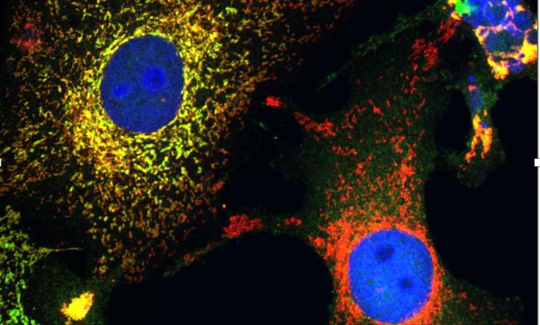 Curbing the cell stress response Curbing the cell stress response