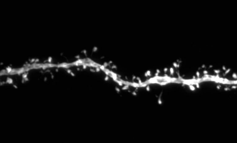 Scientists discover unexpected link between genes involved in human brain evolution and developmental disorders Scientists discover unexpected link between genes involved in human brain evolution and developmental disorders