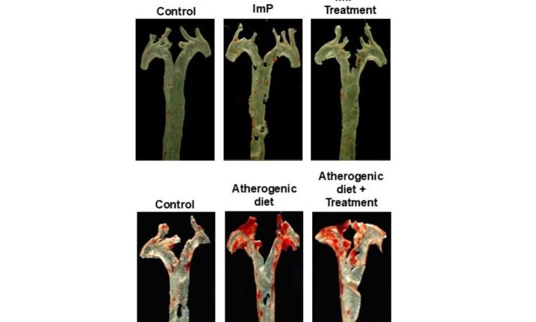 Aortas from mice treated with the bacterial metabolite imidazole propionate (ImP) Aortas from mice treated with the bacterial metabolite imidazole propionate (ImP)