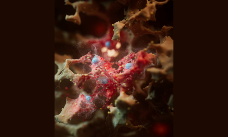 artistic representation of the internal surface of an inflamed alveolus, with significant accumulation of damage that ultimately leads to the release of a 1