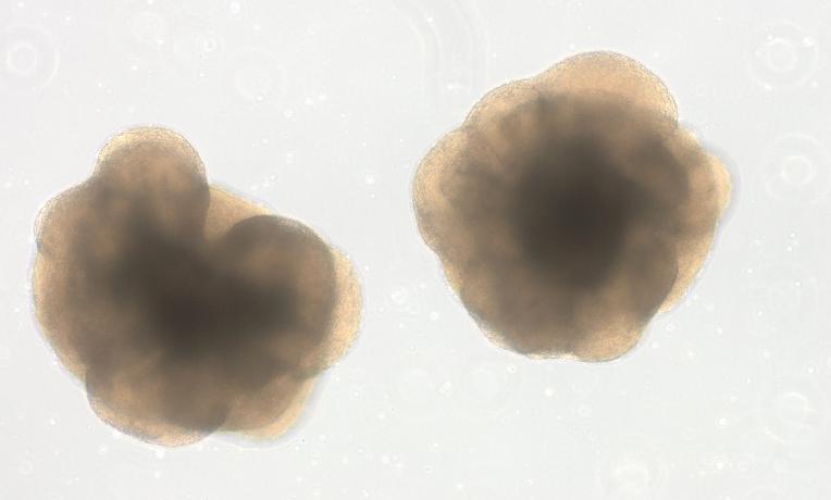 Two brain organoids 