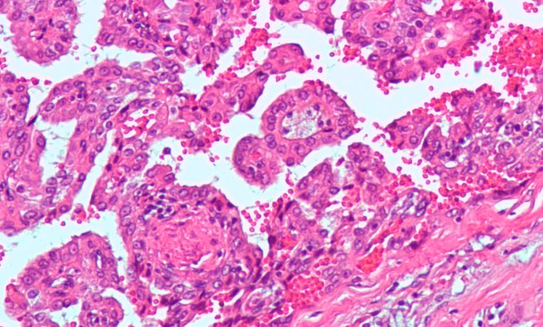 Cover image of Interview with Sir Peter Ratcliffe - 2019 Nobel Laureate: Paving the way for new cancer treatments