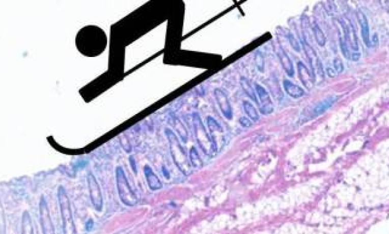 Cover image of How can mucus make systems work more efficiently? Cover image of How can mucus make systems work more efficiently?