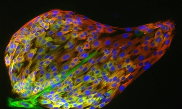 Cover image of Investigating signaling molecules in breast cancer 