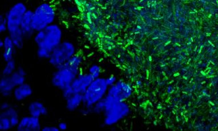 Cover image of Gut bacteria could hold key to new treatments Cover image of Gut bacteria could hold key to new treatments