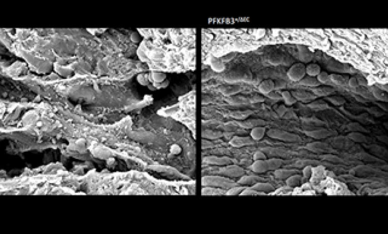 Cover image of Novel therapy starves the engine driving cancer cell growth Cover image of Novel therapy starves the engine driving cancer cell growth