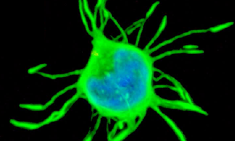 Cover image of Effective targeted treatment for hairy cell leukaemia