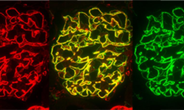 Cover image of New defences against kidney disease in diabetes Cover image of New defences against kidney disease in diabetes