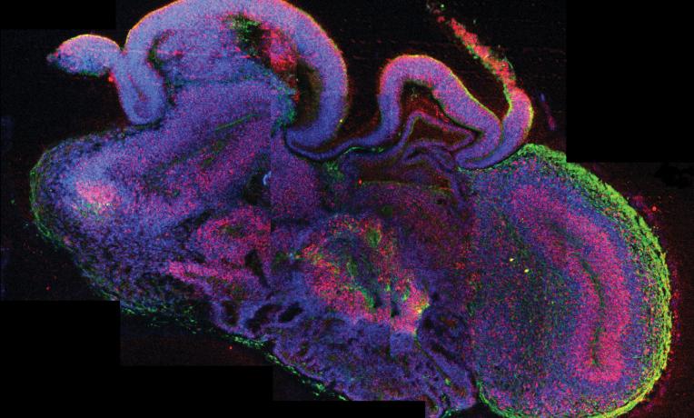 Cover image of Cerebral organoids: an innovative treatment for neurological disorders