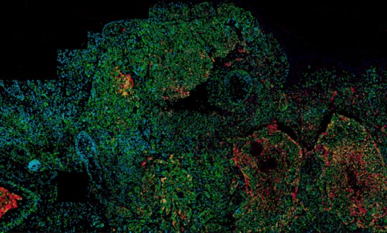 Cover image of Ageing, cancer and the length of your chromosomes