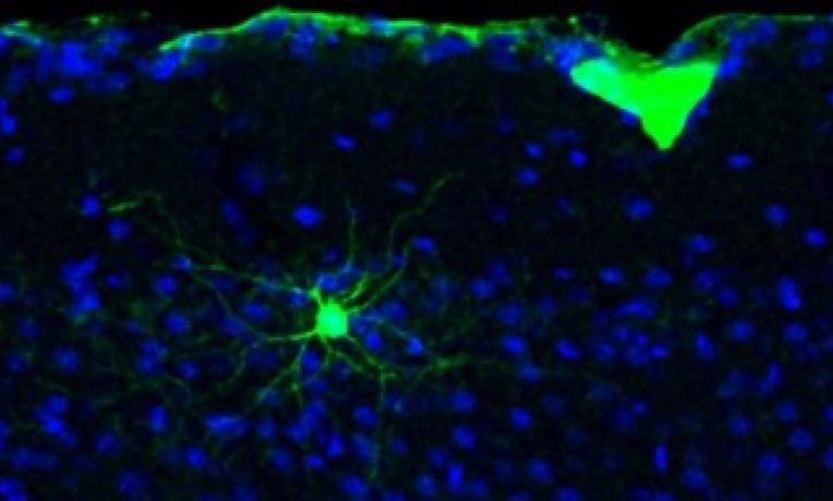 Cover image of The brain: a tuneable 'hardware' Cover image of The brain: a tuneable 'hardware'