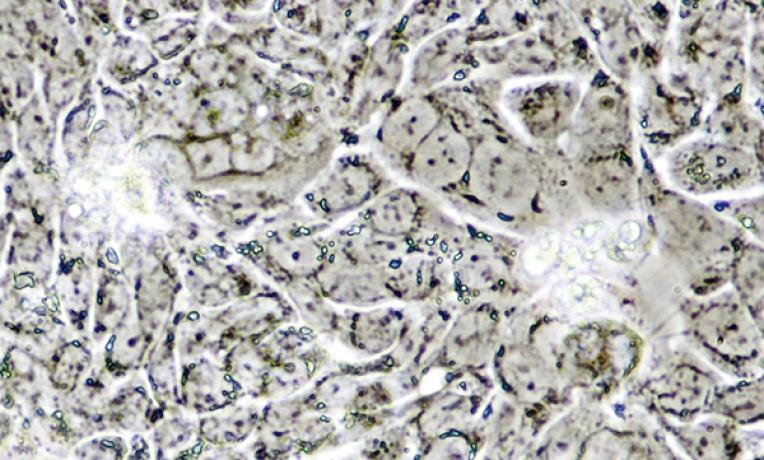 Cover image of An early detection kit for colorectal cancer Cover image of An early detection kit for colorectal cancer