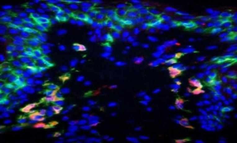 Cover image of Nanovaccines join the fight against cancer Cover image of Nanovaccines join the fight against cancer