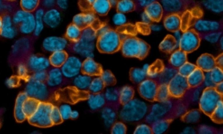 Cover image of Stem cells: from frontier research project to promising spin-off company