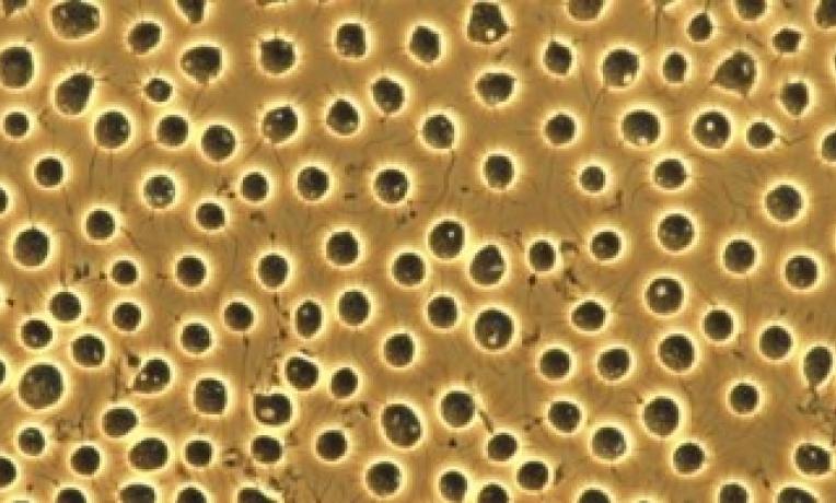 Cover image of ERC grantee uncovers genetic clue to animals' evolutionary success Cover image of ERC grantee uncovers genetic clue to animals' evolutionary success