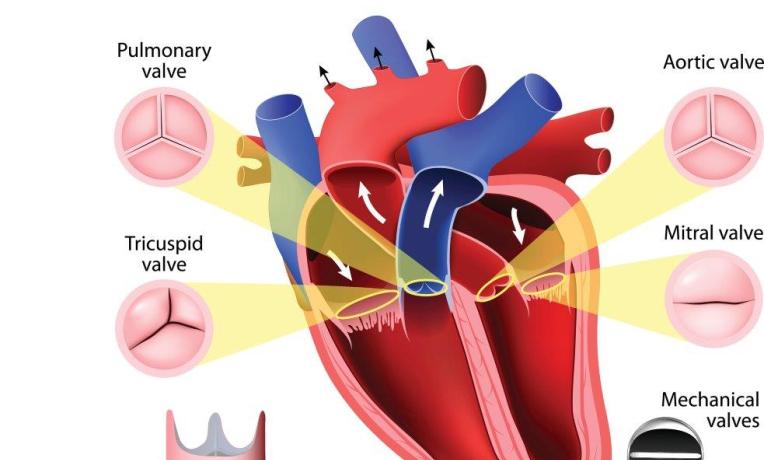 Cover image of Artificial heart valves: synthetic polymer coatings could reduce complications in patients
