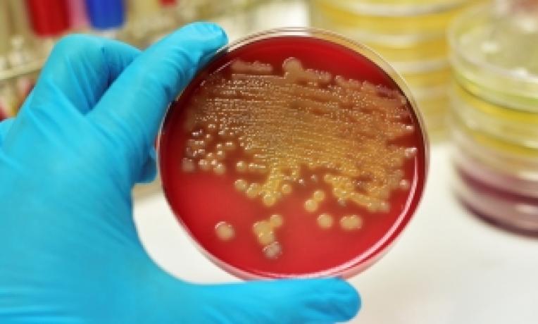 Cover image of New weapons in the fight against antibiotic resistance Cover image of New weapons in the fight against antibiotic resistance