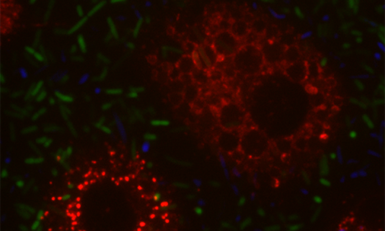 Cover image of New knowledge to fight back against antibiotic resistance Cover image of New knowledge to fight back against antibiotic resistance