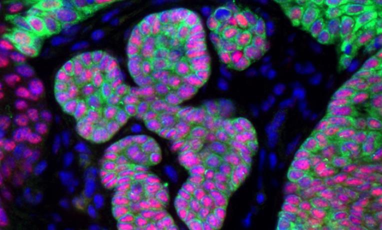 Cover image of Understanding the role of stem cells in skin cancer