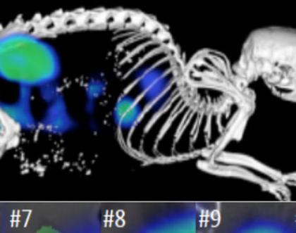 Cover image of Medical imaging: Can we predict how cancer patients will respond to nanotherapies?