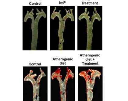 Aortas from mice treated with the bacterial metabolite imidazole propionate (ImP) Aortas from mice treated with the bacterial metabolite imidazole propionate (ImP)