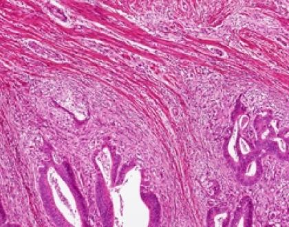Cover image of Cancer in 3D: in-depth research to uncover its secrets