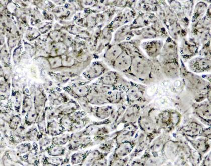 Cover image of An early detection kit for colorectal cancer