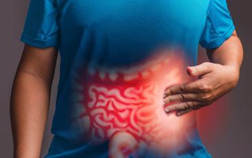 Advancing immunotherapy to solve the colorectal cancer paradox