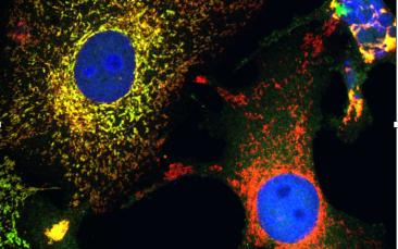 Curbing the cell stress response