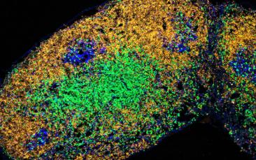 Cover image of Revealing the role T follicular helper cells and the germinal centre play in decreased vaccine efficiency in older people