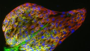 Cover image of Investigating signaling molecules in breast cancer 